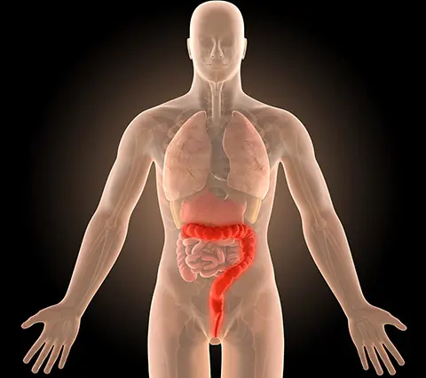 Modelo anatómico que destaca el colon en un examen colonoscopia Bogotá