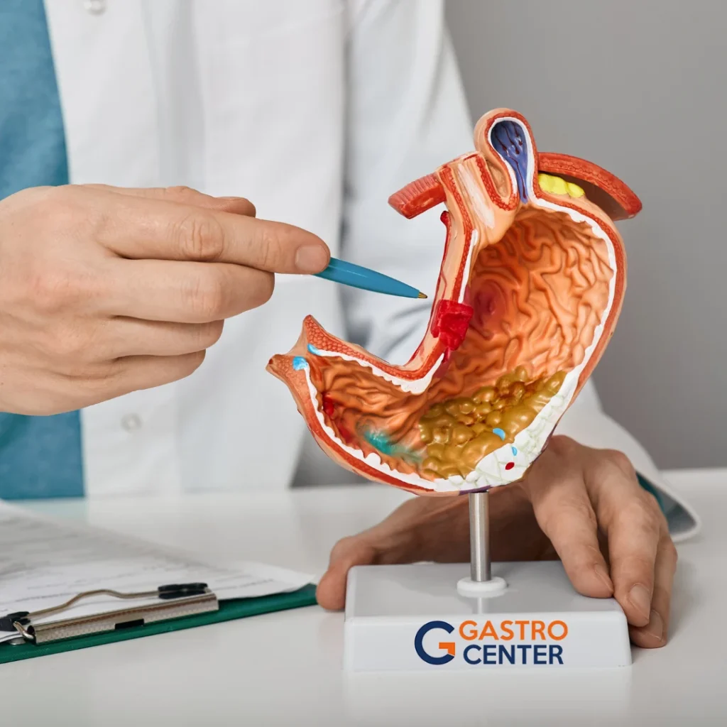 medico señalando con un esfero una figura del sistema gastrico humano sobre soporte de gastro center